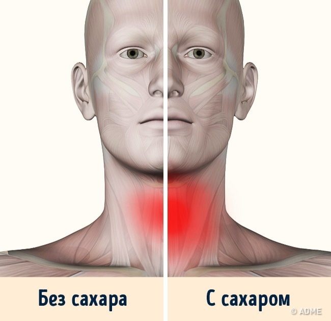 Опасные свойства сахара, о которых мы не подозревали