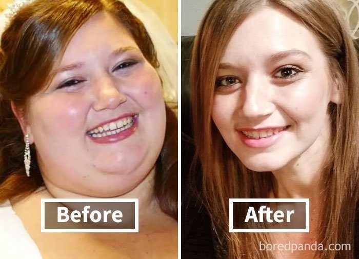 Как меняется лицо после похудения