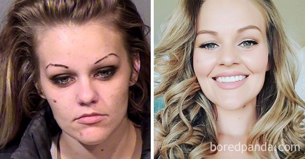 Фотографии людей после того, как они перестали принимать наркотики