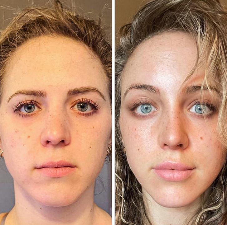 Женщины, которые не постеснялись показать, как косметические процедуры изменили их внешность