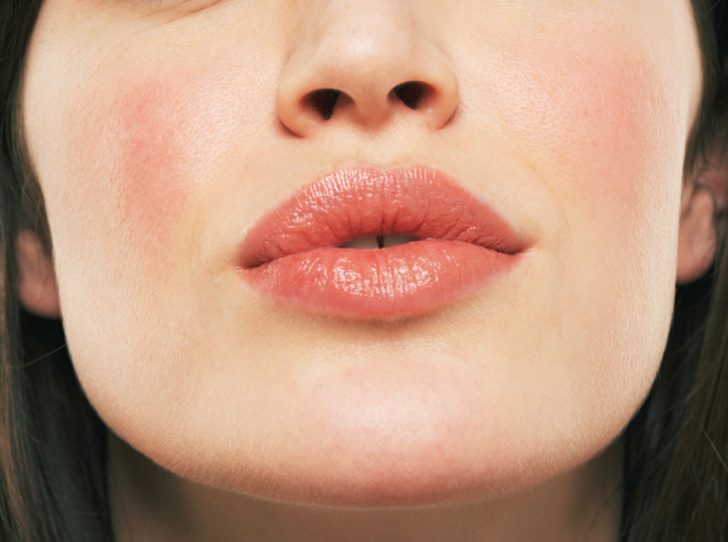 Что губы расскажут о вашем здоровье