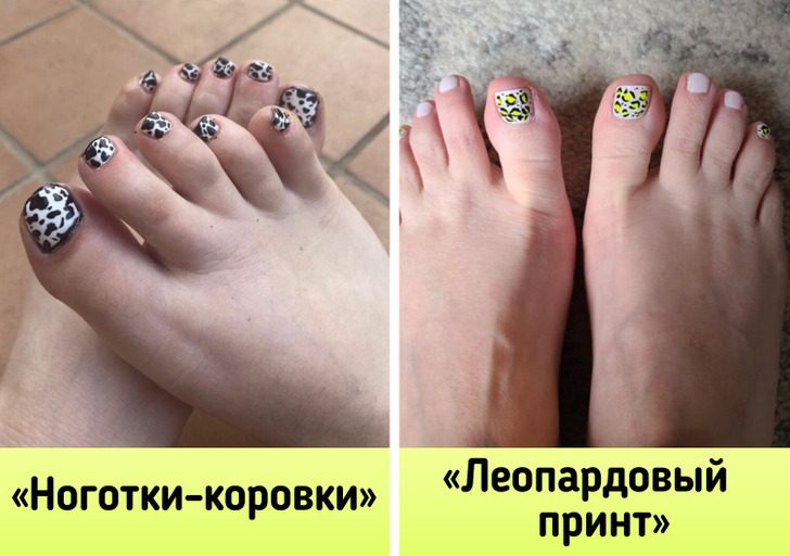 Педикюр, с которым и обувь носить не захочется