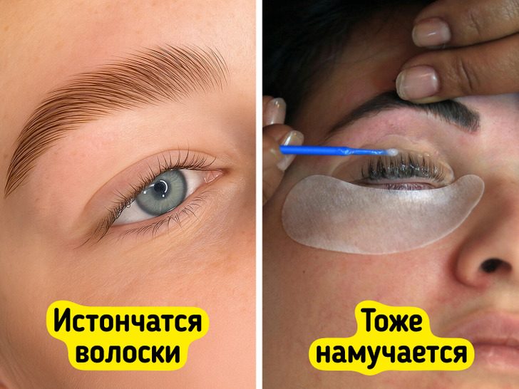 Бьюти-процедуры, которые навредить могут больше, чем радости принести