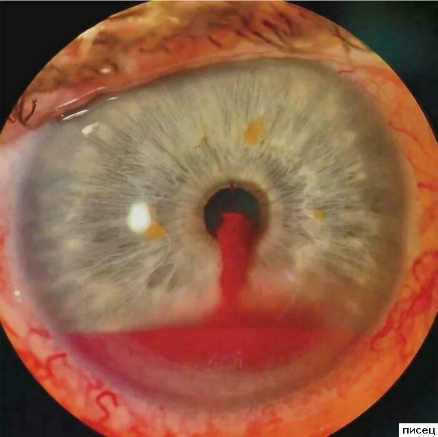 Блин, ну это точно Писец!