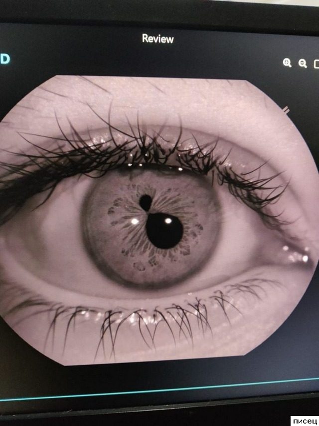 Блин, ну это точно Писец!