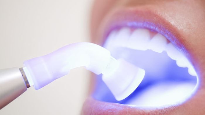 А вы и не знали: вещи, которые наносят вред зубам