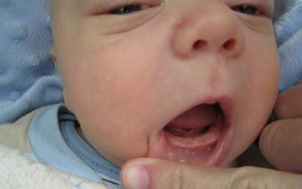 8 советов как помочь малышу при прорезывании зубов