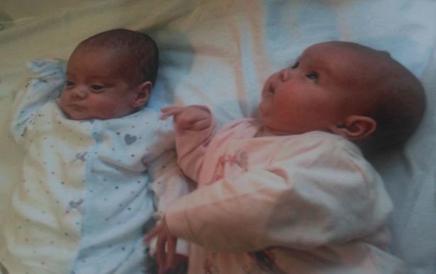 Уникальные двойняшки, которые родились с разницей в 87 дней!