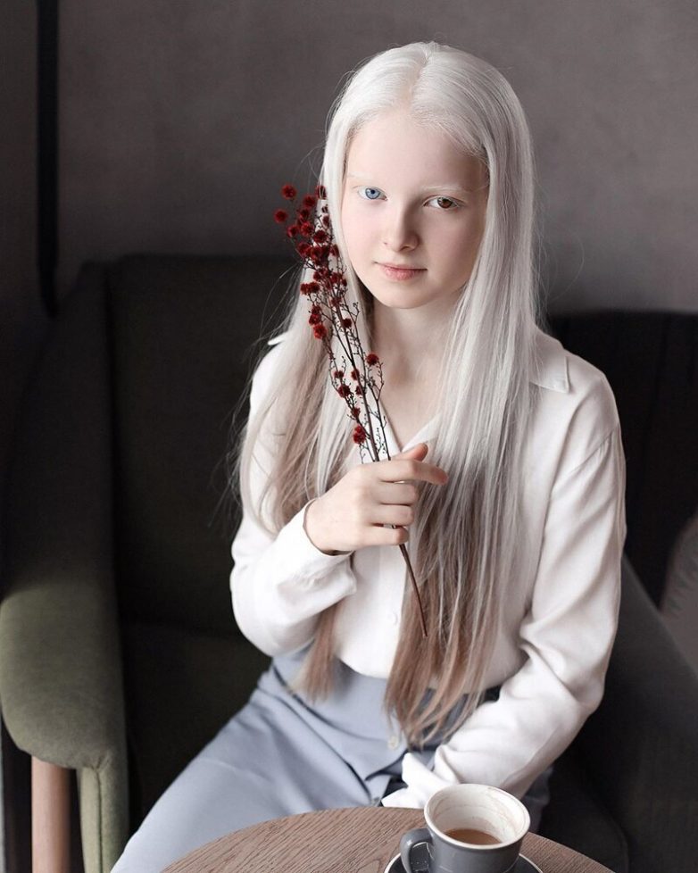 Амина Эпендиева - необычная девочка из Чечни