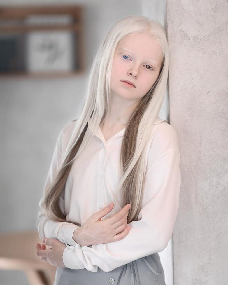 Амина Эпендиева - необычная девочка из Чечни
