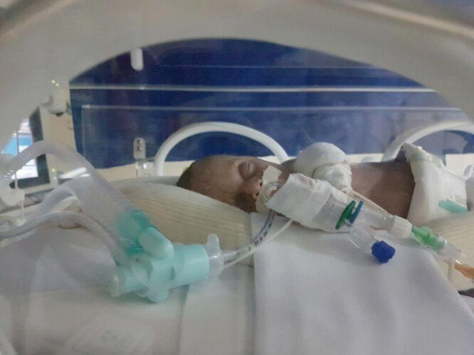 Врачи сотворили чудо: двое малышей родились через 123 дня после смерти матери