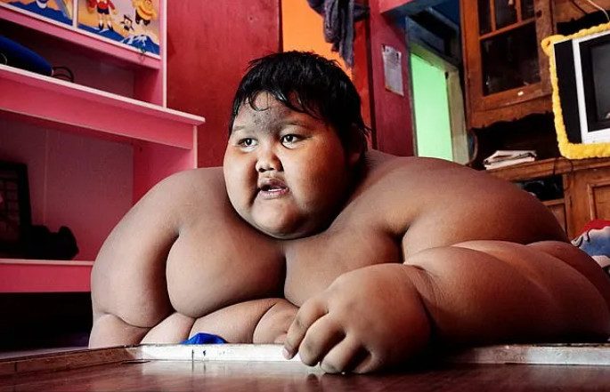 Самый толстый мальчик в мире, который весил 192 кг в 10-лет, сбросил больше 100 килограммов