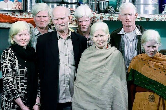 Самая большая в мире семья альбиносов из Индии