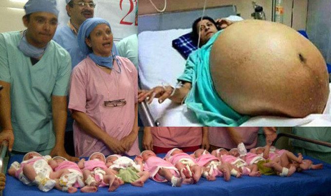 Жительница Индии в возрасте 42-х лет за 37 минут родила 11 детей