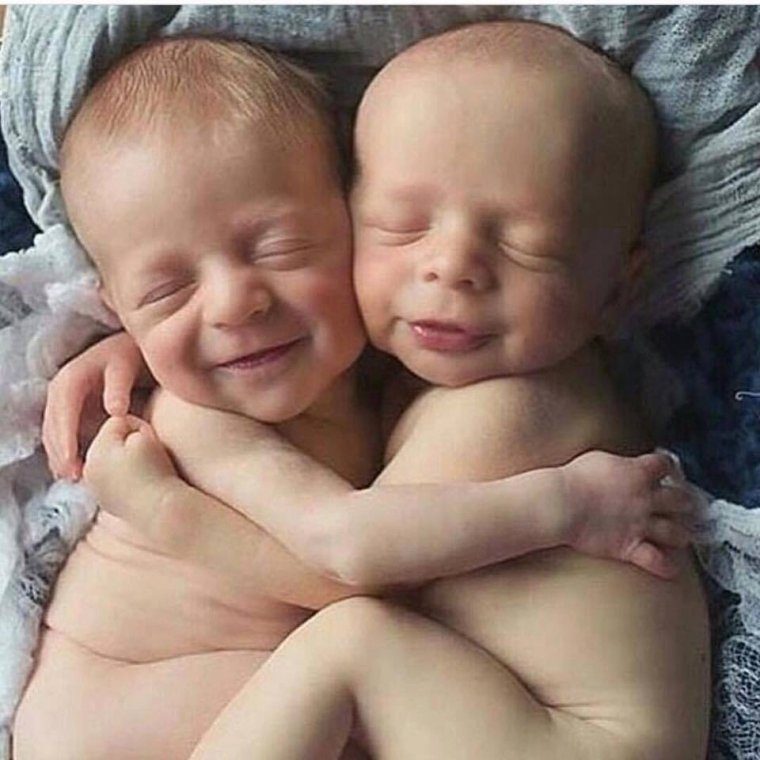Гетерозиготные близнецы фото