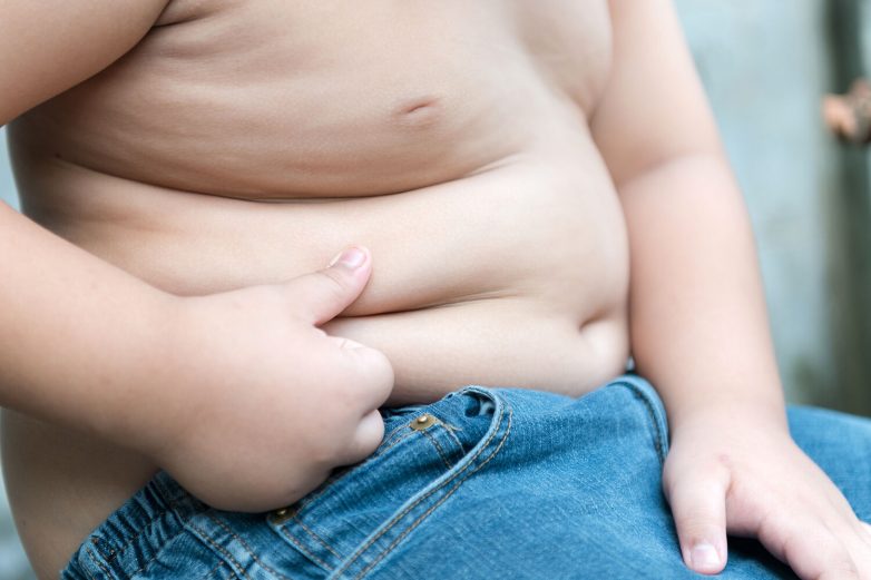 Как справиться с детским ожирением