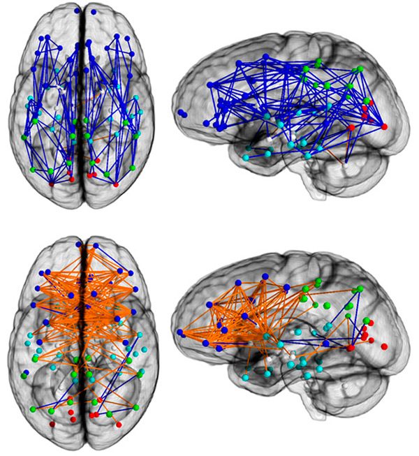 Учёные выявили принципиальные различия в устройстве женского и мужского мозга