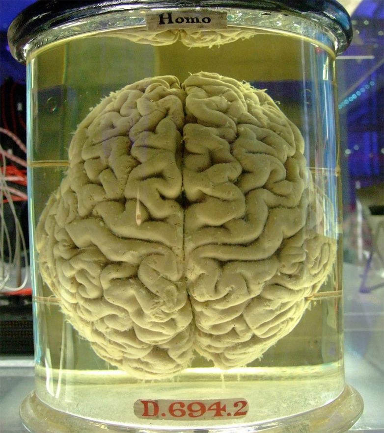 Загадки человеческого мозга