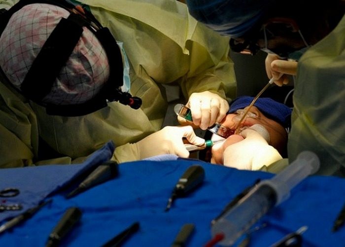 7 хирургических операций с невероятными и непредсказуемыми последствиями