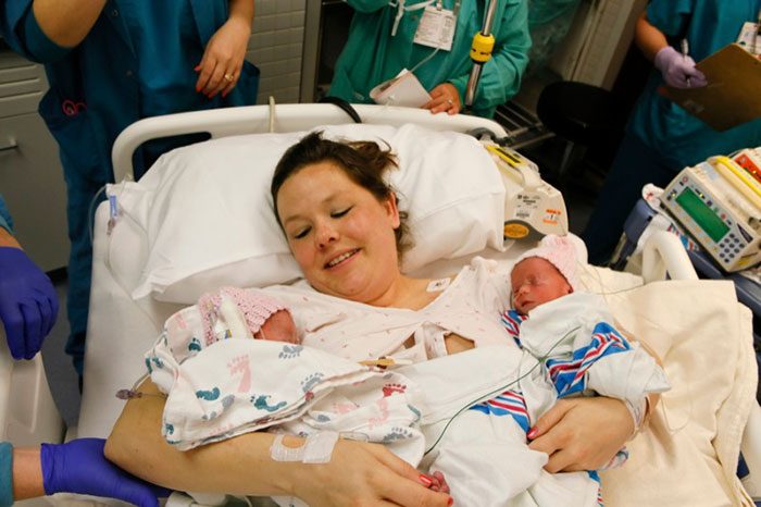 Трогательная история близнецов: держаться за руки с рождения