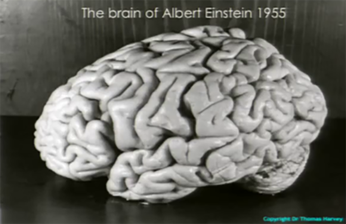 Что случилось с мозгом Эйнштейна после смерти учёного