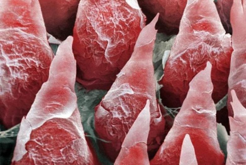 Как выглядит наше тело под микроскопом