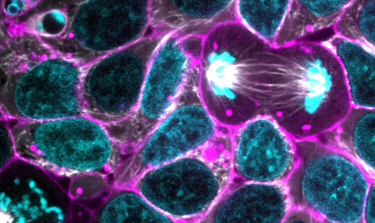 Австралийские учёные смогли остановить смерть клеток