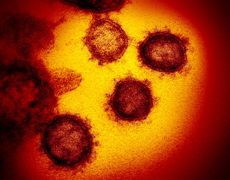 Разглядываем коронавирус под микроскопом