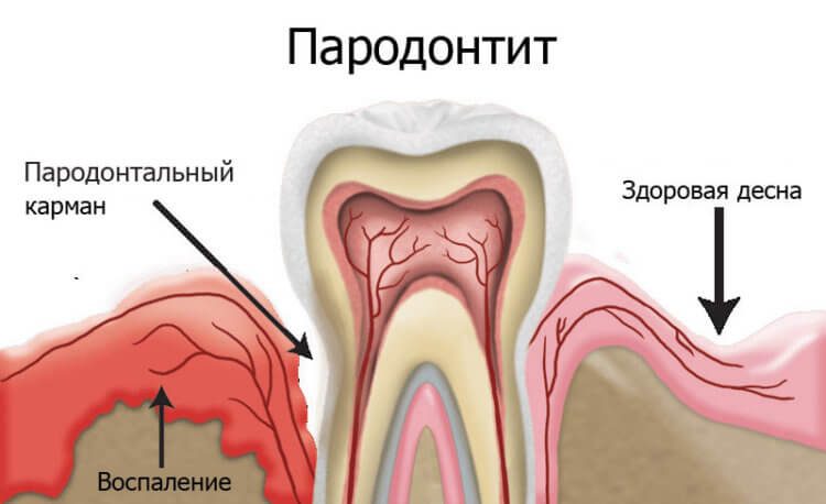 Учёные разгадали секрет зубов Анны д&#39;Аллегри