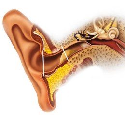 Серная пробка в ушах в ушах: удаление в домашних условиях