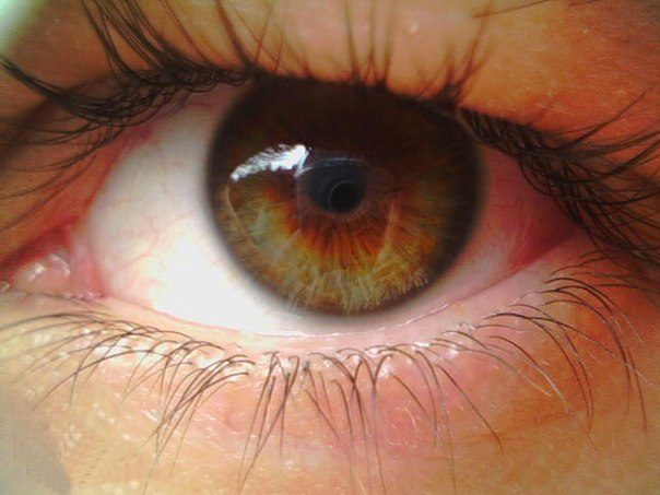 Дистрофия сетчатки глаза: симптомы, народные рецепты лечения