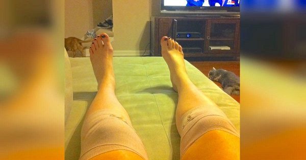 Лечение коленных суставов народными средствами