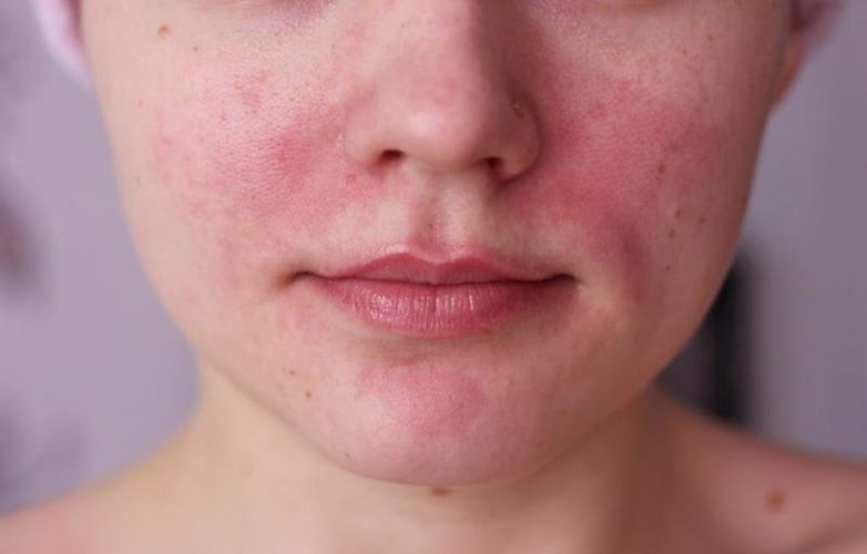 10 сигналов о состоянии организма, которые ваша кожа посылает вам