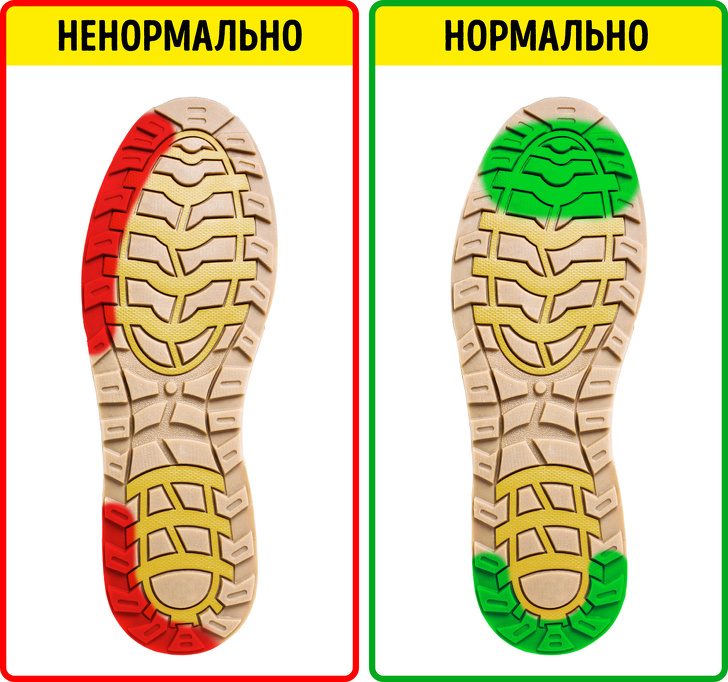 Заболевания, которые можно предупредить, если внимательно посмотреть на вашу обувь