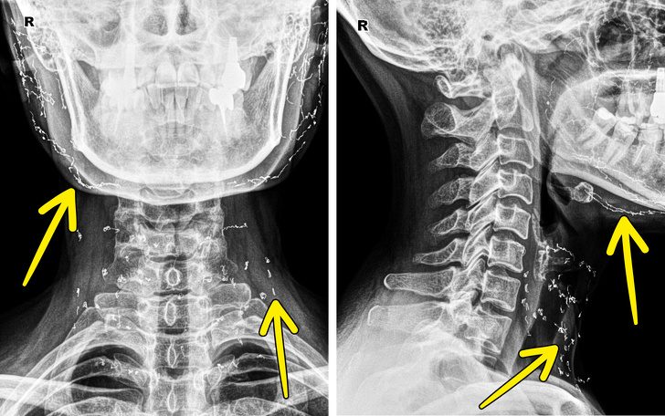 Рентгеновские снимки, которые расскажут лучше, чем учебник по анатомии