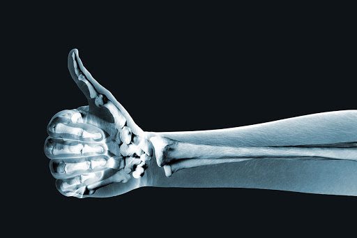 Как улучшить здоровье костей