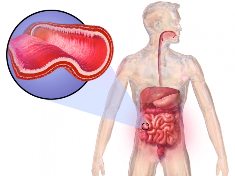 Как кишечник влияет на состояние организма