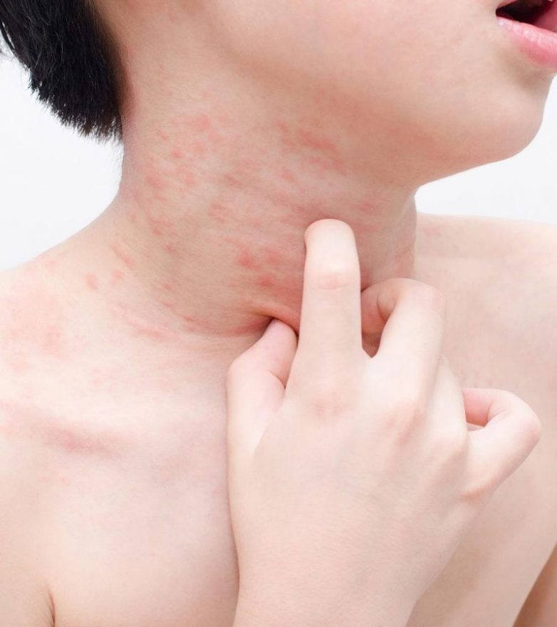 Сигналы кожи, которые предупреждают о серьезных заболеваниях