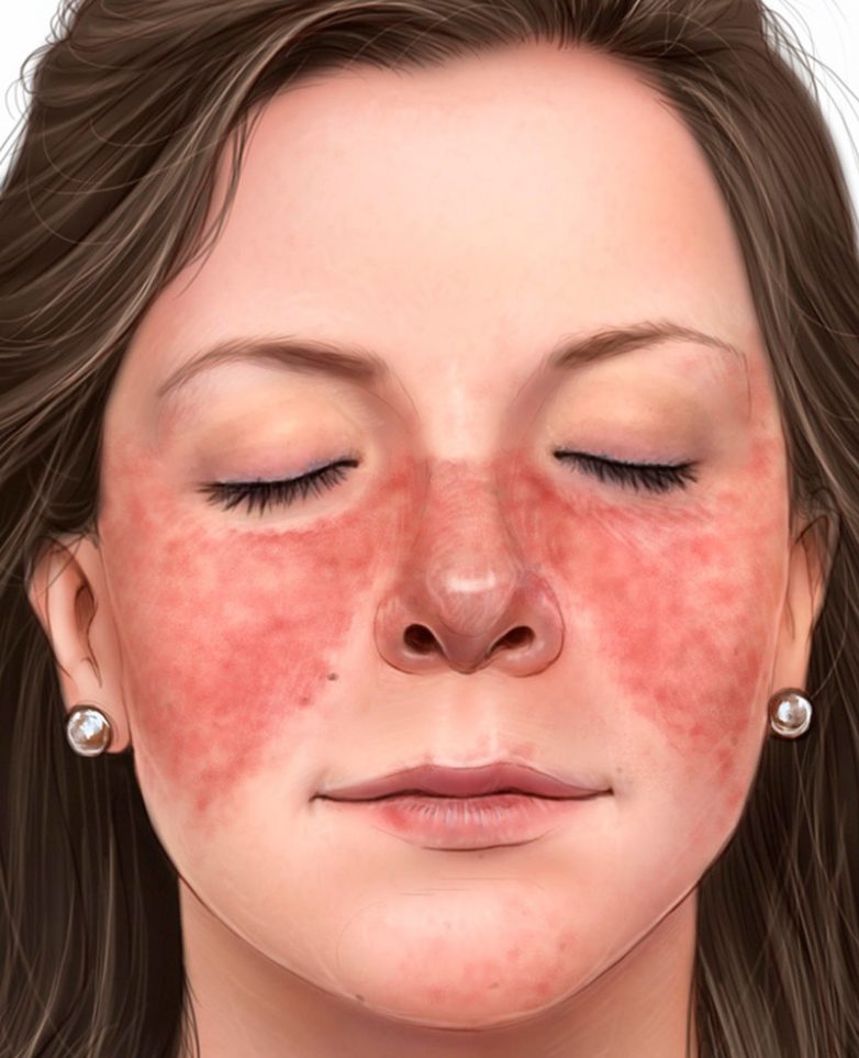 Сигналы кожи, предупреждающие о серьёзных заболеваниях