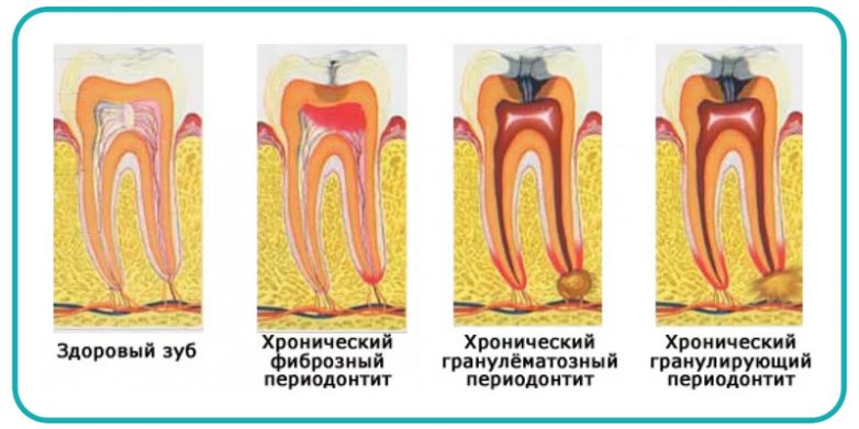 Смертельно опасные привычки, которые вы можете считать безобидными