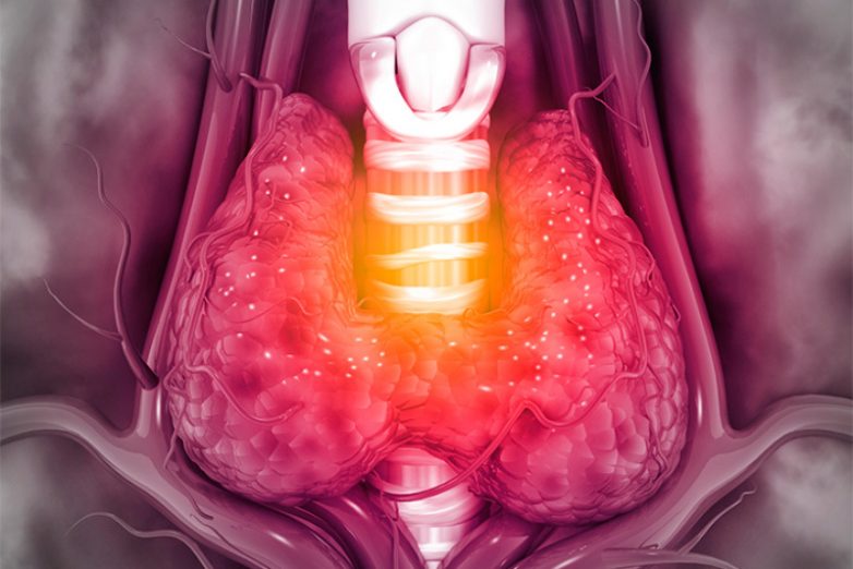 Профилактика и лечение заболеваний щитовидной железы
