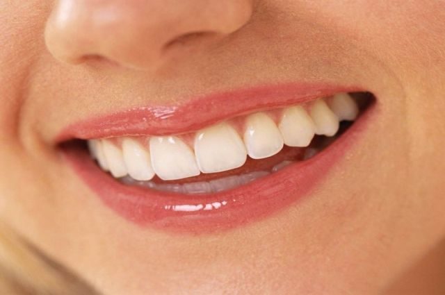 Почему появляется налёт на зубах и как от него избавиться