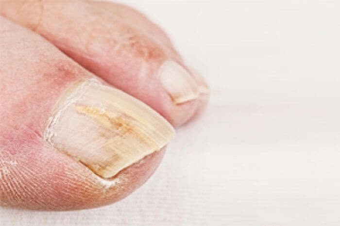 Что ногти расскажут о вашем здоровье