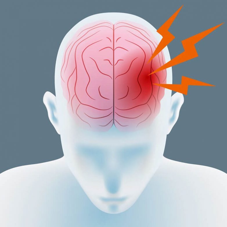 Симптомы аневризмы сосудов головного мозга