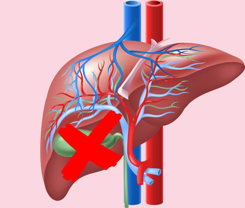 Что можно и что нельзя если нет желчного пузыря?