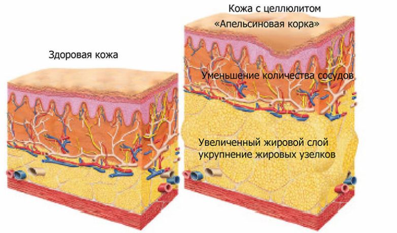 Надежный способ избавления от жира на животе и боках. Убираем все лишнее!