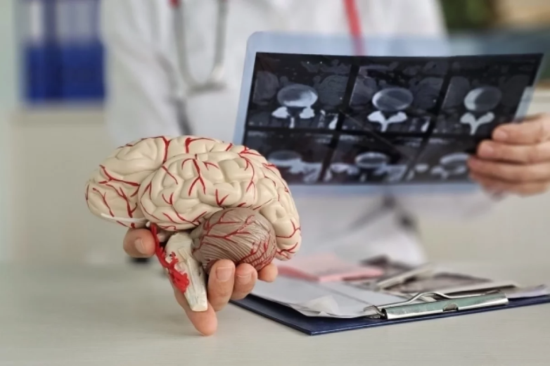 Деменция не пройдет. Определены ключевые продукты, приводящие к Альцгеймеру