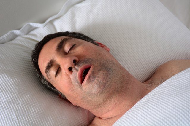 Как связаны апноэ сна и деменция?