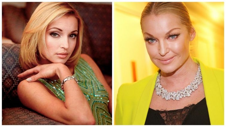 Как с годами изменилась внешность российских и голливудских звёзд