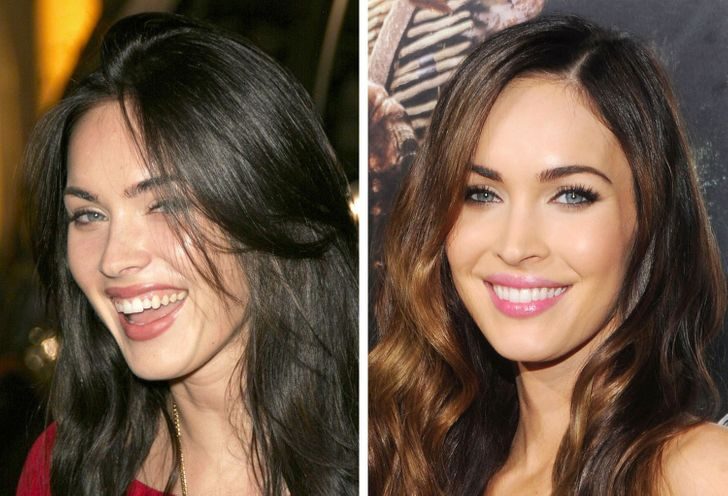 Как изменились улыбки знаменитостей после того, как они исправили свои зубы